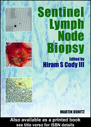 Sentinel lymph node biopsy