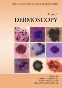 An Atlas of Dermoscopy, Kindle Edition