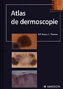 Atlas de Dermatoscopie