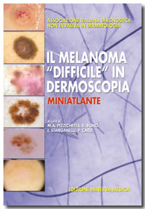 libro su melanoma Pizzichetta