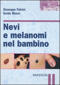 nevi e melanomi Fabrizi