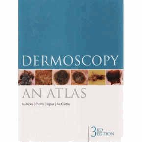 Dermoscopy Atlas