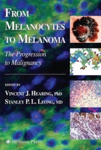 from melanocytes to melanoma